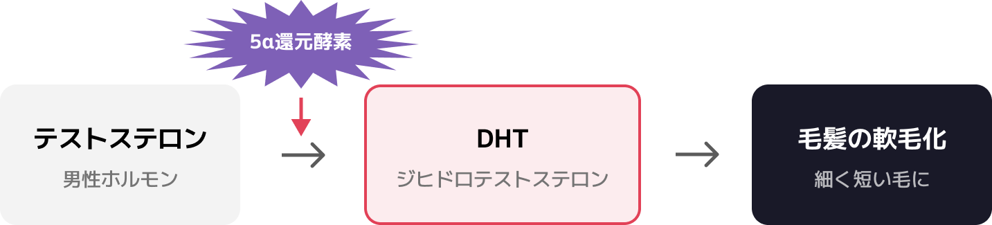 AGAのメカニズム：テストステロンが5α還元酵素によってDHTに変換され、毛髪の軟毛化を引き起こす